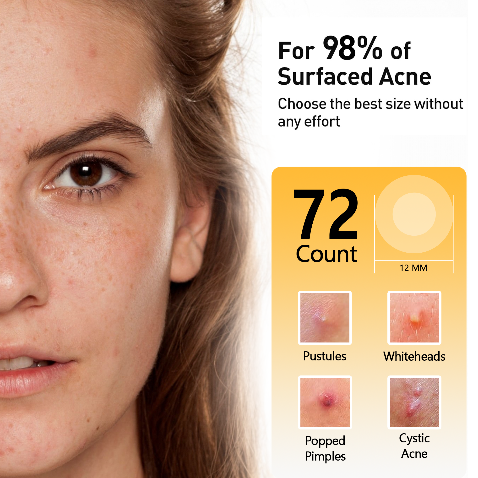 CanVita Pimple Patches - 72 Dots of Effective Solution for Skin Care - Canvita