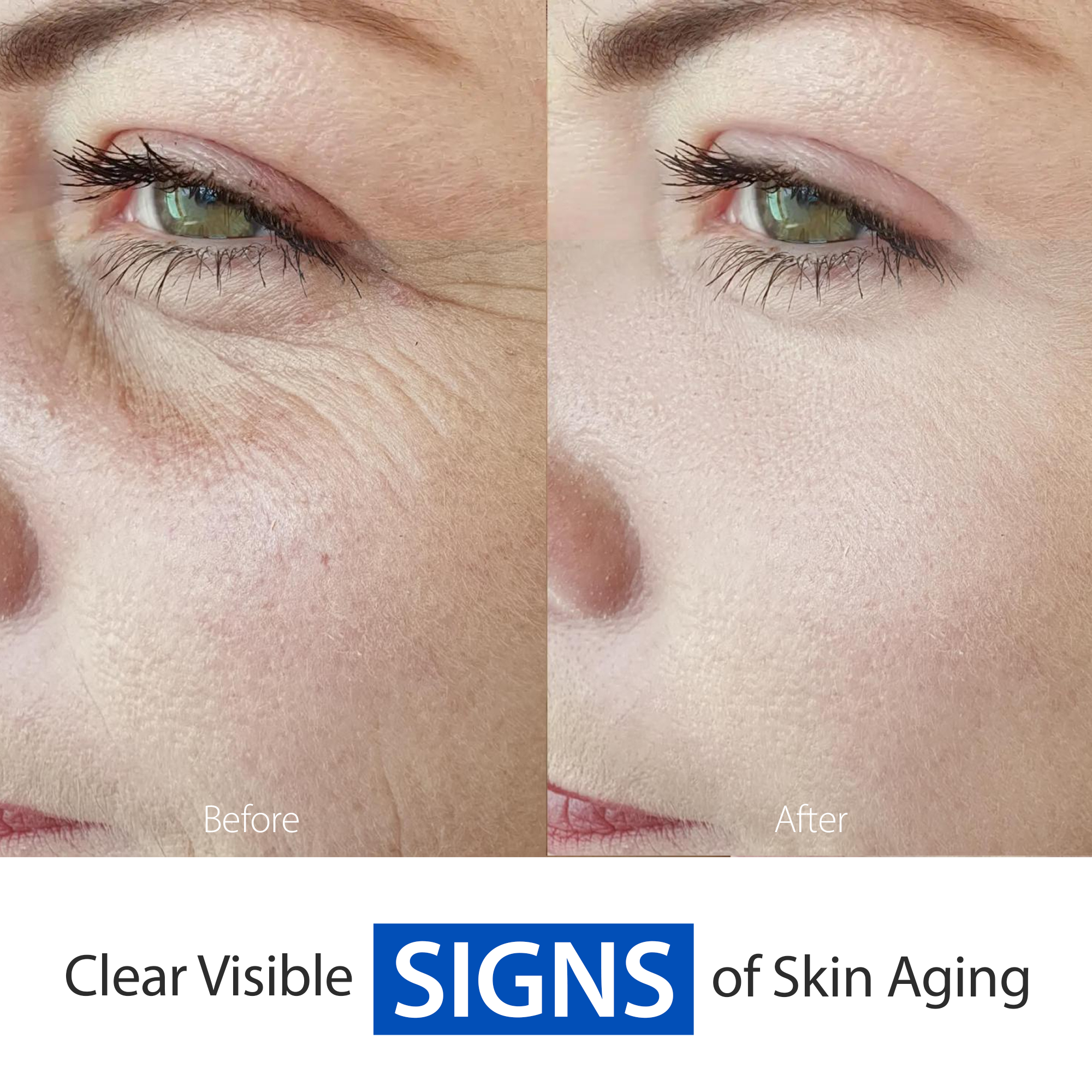 CANVITA Moisturizing 6 in 1 Anti Aging face Cream